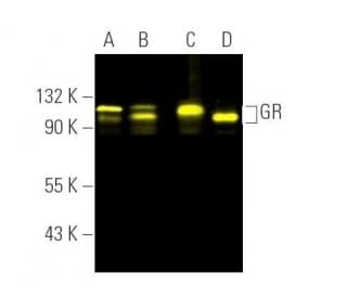 GR/NR3C1/Glucocorticoid Receptor Antibody (G-5) | SCBT - Santa Cruz ...